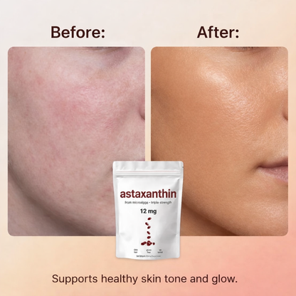 Anti-Aging soft gels